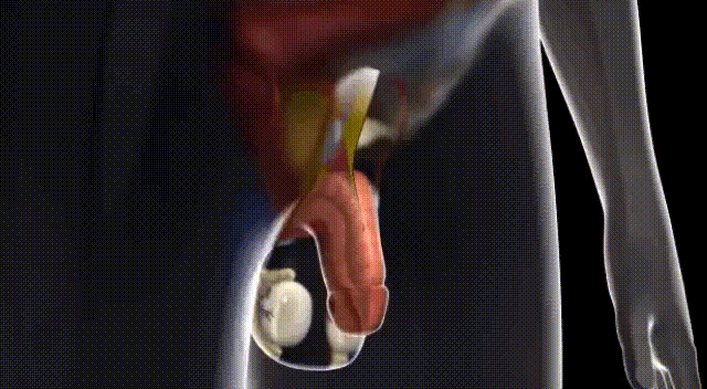 nKSCMVZD3Fp9nJ81E3j1D4fJEi03HI6HtD7gwhn7.gif